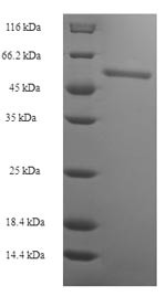 GMP reductase 2 (GMPR2), human, recombinant