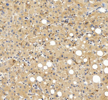 Anti-FGL1 / Fibrinogen-like protein 1