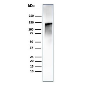 Anti-Caldesmon / CAD HMW, clone CALD1/1424R