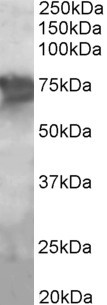 Anti-PCK2 / PEPCK-M, Internal