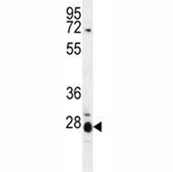 Anti-IL17B