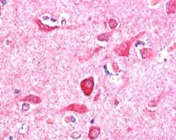 Anti-NIR1 / PITPNM3, C-terminal