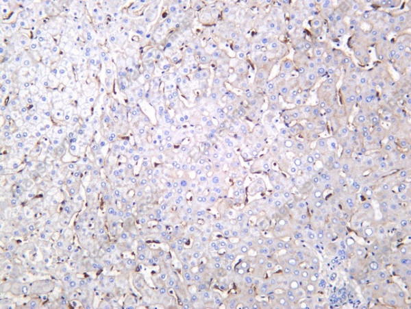 Anti-Recombinant FCGRT, clone C312393