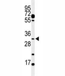 Anti-APOBEC3B