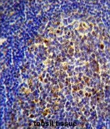 Anti-CHRNA10