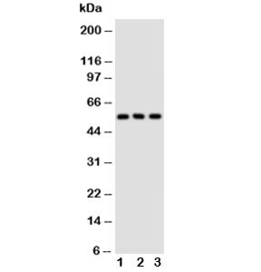 Anti-GLUT5 (Glucose transporter 5)