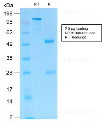 Anti-MART-1 / Melan-A / MLANA (Melanoma Marker) Recombinant Mouse Monoclonal Antibody (clone:rMLANA/