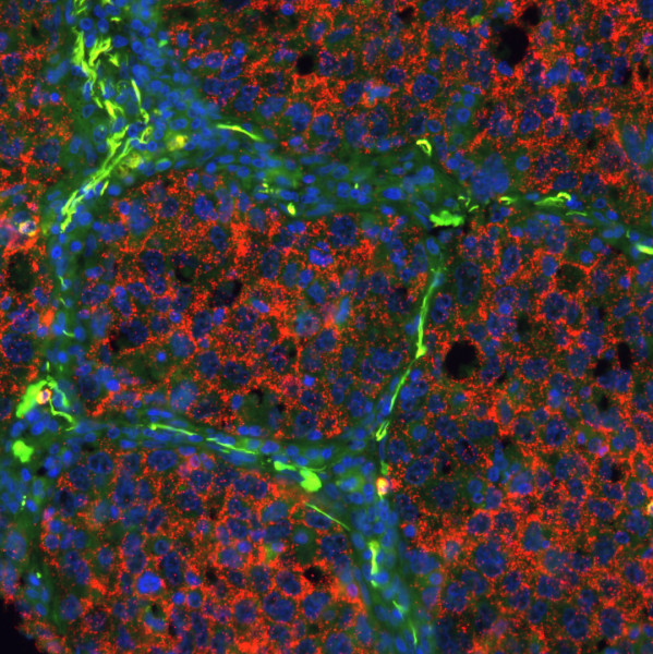 Beta-Catenin-and-E-Cadherin