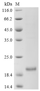 Enhancer of yellow 2 transcription factor homolog (ENY2), human, recombinant