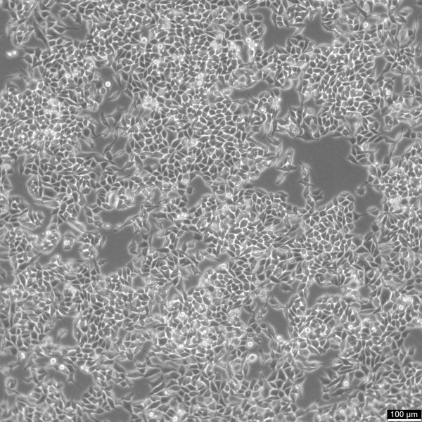 RKO Cells