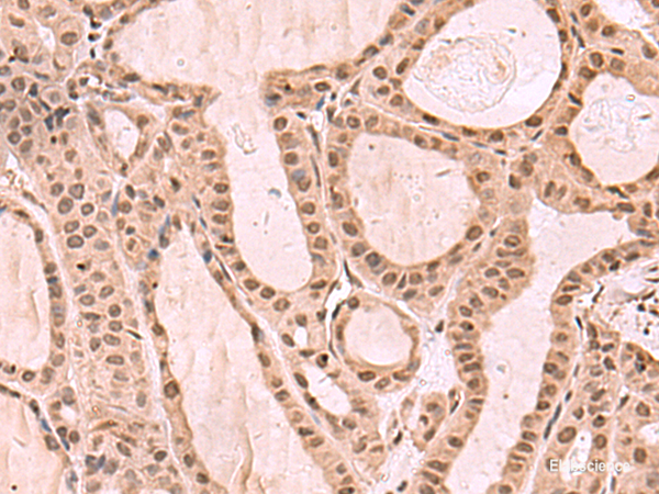 Anti-KDM7A