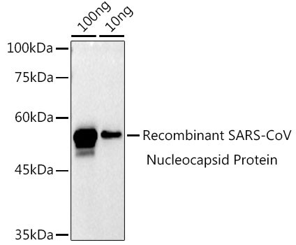 Anti-SARS-CoV-2 N Protein