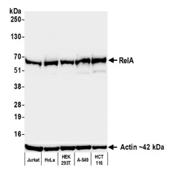 Anti-RelA Recombinant Monoclonal