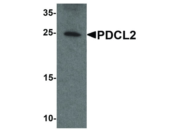 Anti-PDCL2