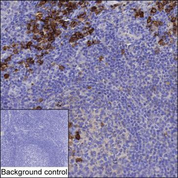 Anti-CD38