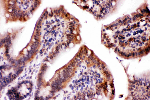 Anti-LDHA / Lactate Dehydrogenase