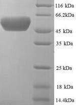 Periplasmic serine endoprotease DegP (degP), Escherichia coli, recombinant