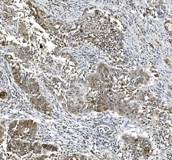 Anti-Cyclooxygenase 2 / COX-2 / PTGS2