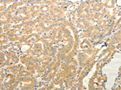 Anti-TPH1