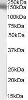 Anti-EPB41L3 / DAL1, C-terminal