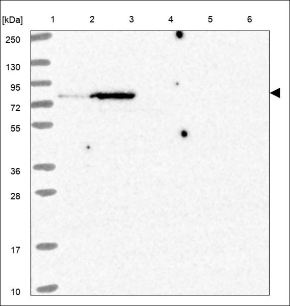 Anti-GPSM1