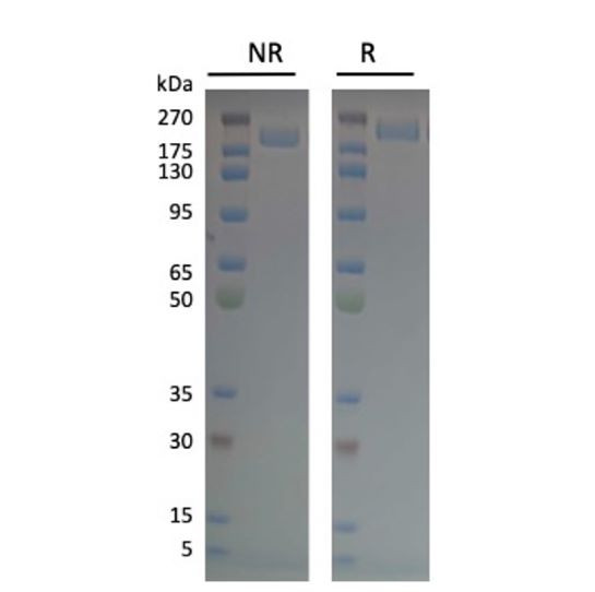Spike Trimer (S1+S2) (BA.2.75.2, Omicron Variant), His-Tag (SARS-CoV-2) Recombinant