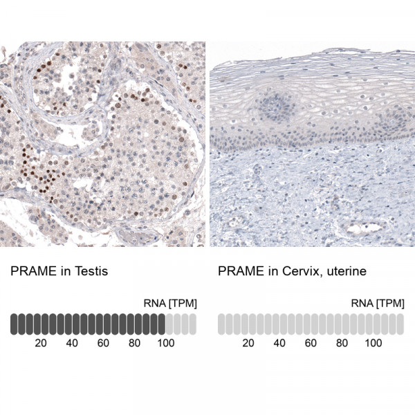 Anti-PRAME, clone CL5148