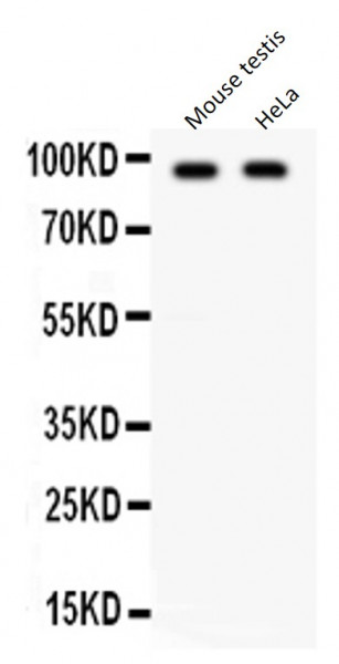 Anti-CIP2A / KIAA1524