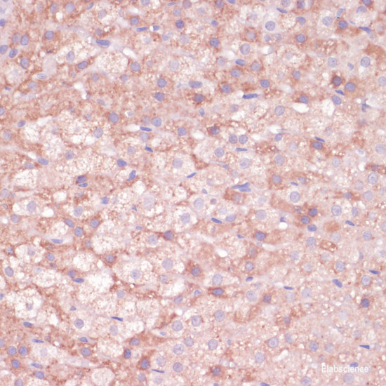 Anti-CYP11B2
