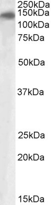 Anti-PLA2R1, Internal