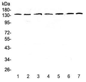 Anti-EIF2AK3 / PERK