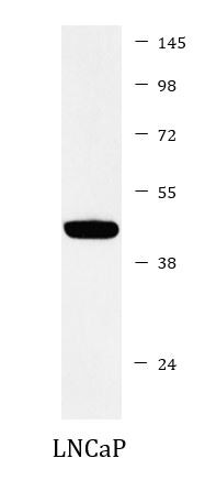 Anti-PDK1 / Mitochondrial Pyruvate Dehydrogenase Kinase 1