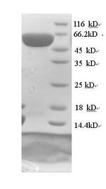 Dihydropyrimidinase-related protein 1 (CRMP1), human, recombinant