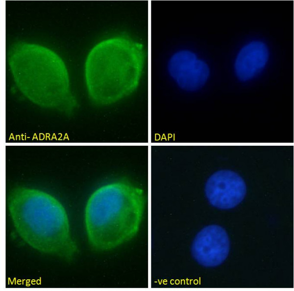 Anti-ADRA2A, Internal