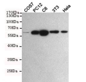 Anti-Pyruvate Kinase / PKM2, clone 1A7-G6-H6