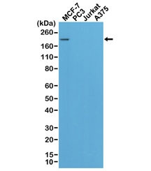 Anti-HER2, clone RM228 (recombinant antibody)