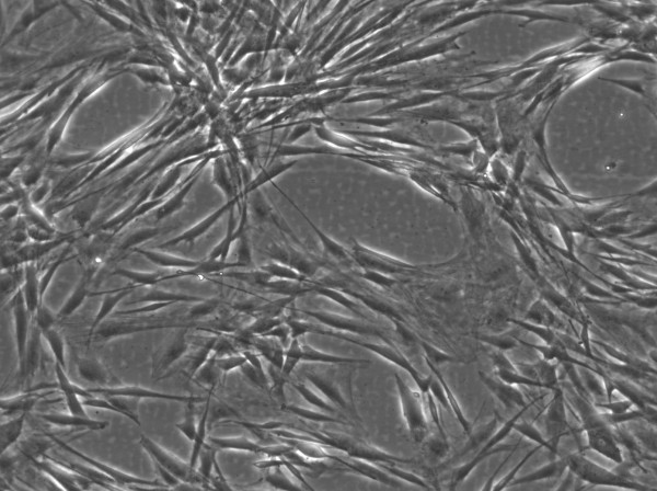 Wilms6 Cells
