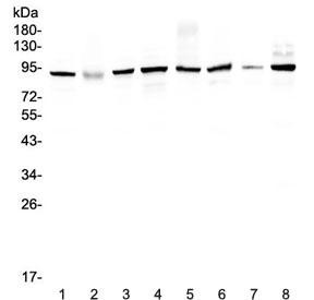 Anti-UBA2 / SUMO-activating enzyme subunit 2 / SAE2