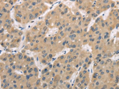 Anti-TRIB3
