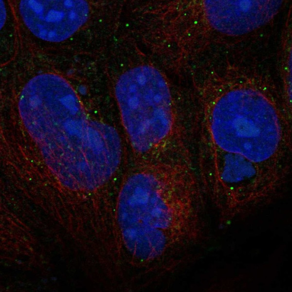Anti-WNT3
