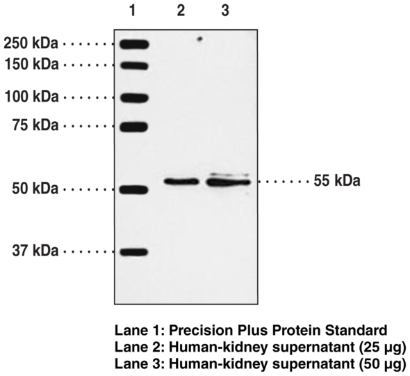 Anti-BLT1 Receptor Antiserum