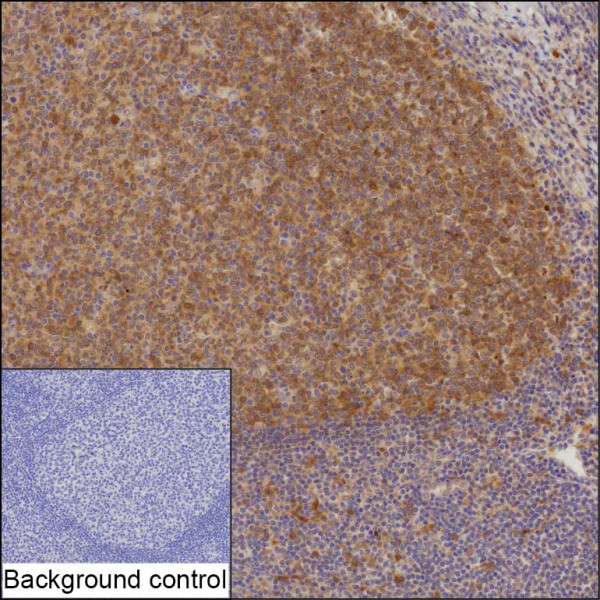 Anti-RRM2B