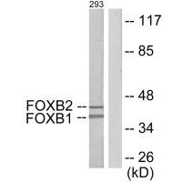 Anti-FOXB1/FOXB2
