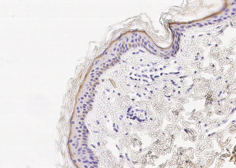 Anti-Cystatin E/CST6 Monoclonal Antibody