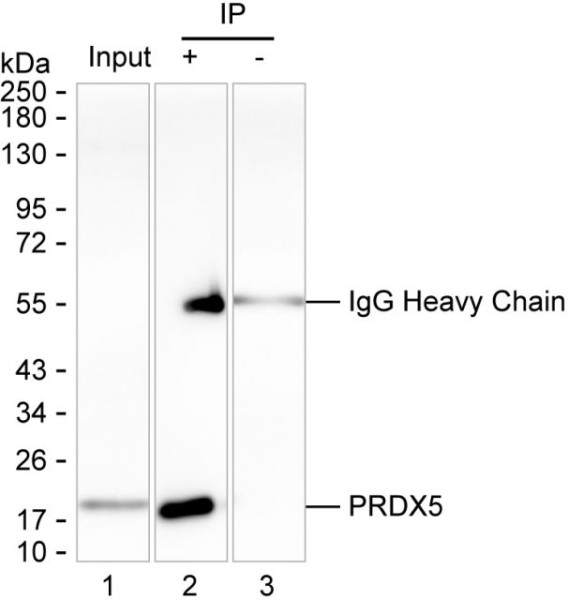 Anti-Peroxiredoxin-5