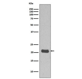 Anti-HRAS, clone BEA-8