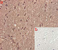 Anti-Progranulin (human), clone PG359-7