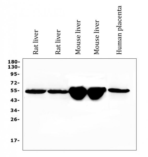 Anti-DBP / Vitamin D Binding protein