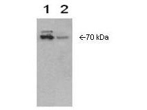 Anti-COX-2 (Cyclooxygenase-2, PGHS 2, Prostaglandin Endoperoxide Synthase-2, PHS 2), human