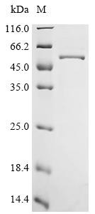 Heparan-sulfate 6-O-sulfotransferase 1 (HS6ST1), partial, human, recombinant